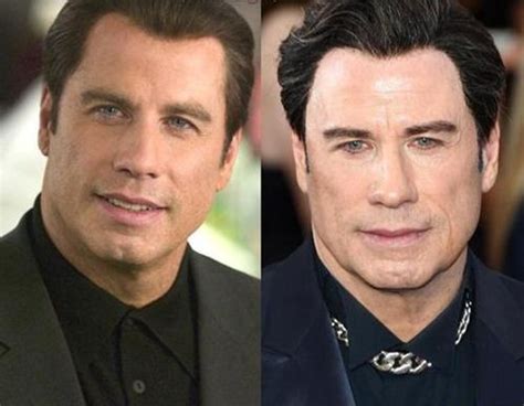 john travolta face lift|John Travolta Plastic Surgery Photos [Before & After]